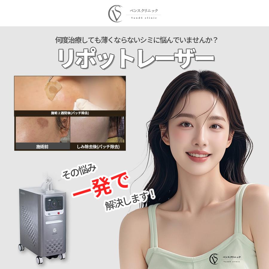 リポットレーザー ‟しみを一発で取り除く✨”